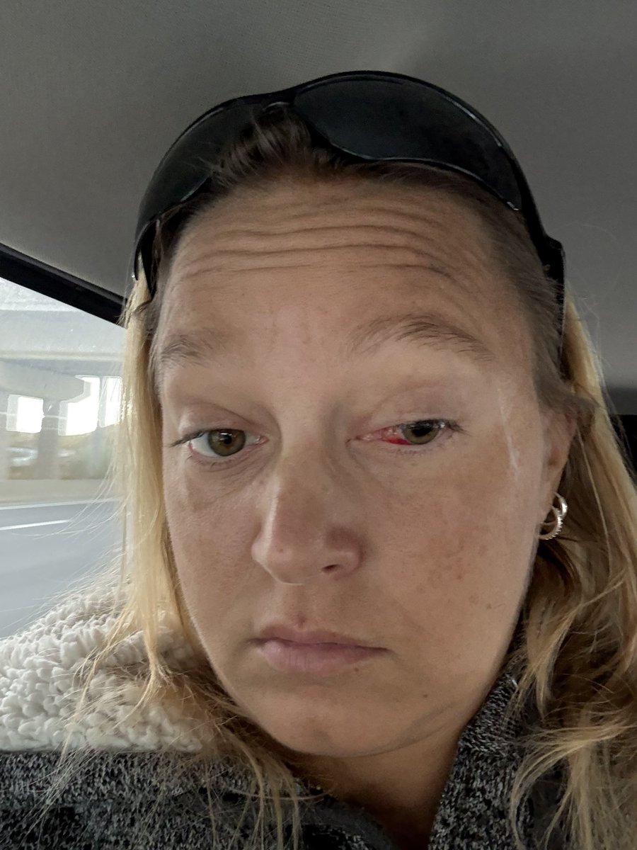 Not sure who’s still waiting to interview me or who wants to do it again but let’s be real:
I’m paralyzed. I’ve lost my bowel, my bladder, and now my vision in one eye. Maybe soon, my life.
But I have NOT lost my voice.
Let me tell my truth while there’s still time to hear it.