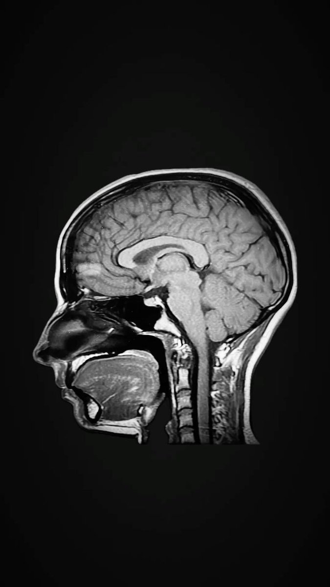 edificance's tweet image. heyyo #studytwt #langtwt #booktwt #promotwt !!

✶ call me aux, any pronouns ^_^
✶ learning 🇯🇵 🇧🇷🇨🇳
✶ igcse triple sci &amp;amp; bs student! on the grind
✶ self-studying neuroscience and psych
✶ likes learning science, bio, physics, nonfiction, manga, sherlock

♡/⟳ 4 #moots !!