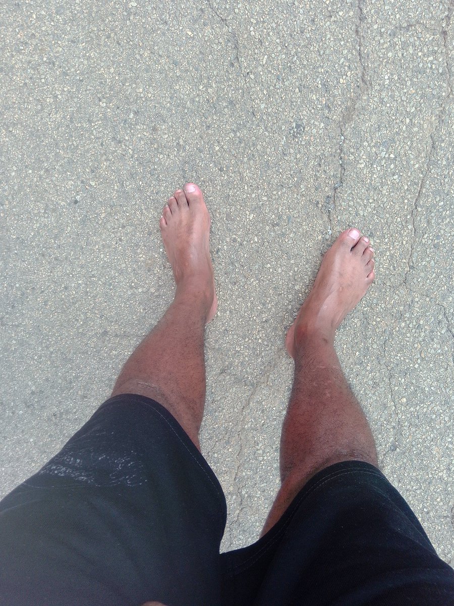 My legs are man's leg,it's shows that im Shaka Zulu young generation,i can walk bare foot anywhere,i love being me and ill always be Beast...!💯🔥🐐🦁👑