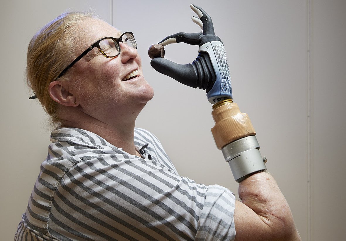 ampowerApp's tweet image. « Grâce à des échanges avec des amputés comme moi, j’ai repris confiance après mon amputation » 

– Un témoignage qui pourrait être le vôtre sur Ampower. Notre réseau social booste les parcours : connexions, tips prothèses et motivation. 

Inscrivez-vous : ampower.fr