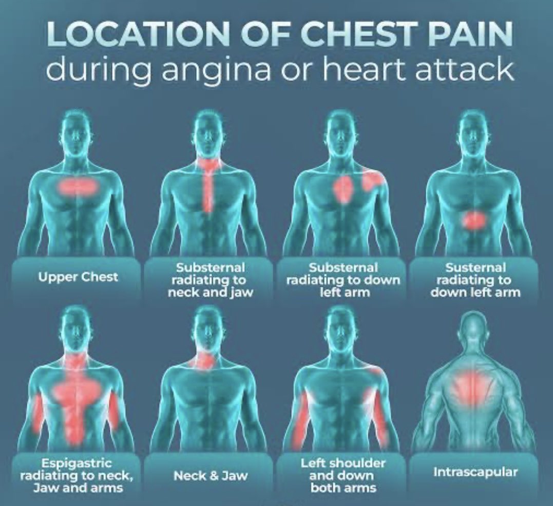 ٦١ سنه
ارتفاع ضغط الدم من ٥ سنوات .. جاني وقتها العياده وأعطيته دواء تحكم في الضغط ..
اختفى بعدها و ما صار يتابع في العياده 🤦🏻‍♂️!!.. 
جاني العياده الأسبوع الماضي يشتكي من ألم في الجانب الأيمن من العنق خلال المشي والحركه !.. الأعراض غريبه وشكيت أنها نتيجة تصلب في شرايين القلب كون