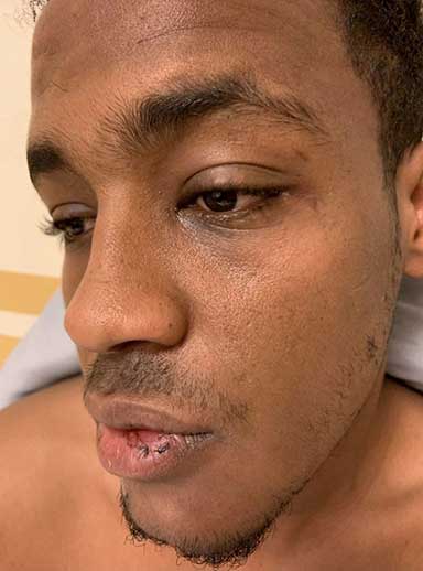 christianpet_'s tweet image. 🚨🇸🇪 Court of Appeal halted the deportation of a Somali rapist, claiming “it’s difficult to be homosexual in Somalia.”

Abdurahman Ismail raped his male neighbor on camera — yet apparently even that wasn’t enough to deport him.