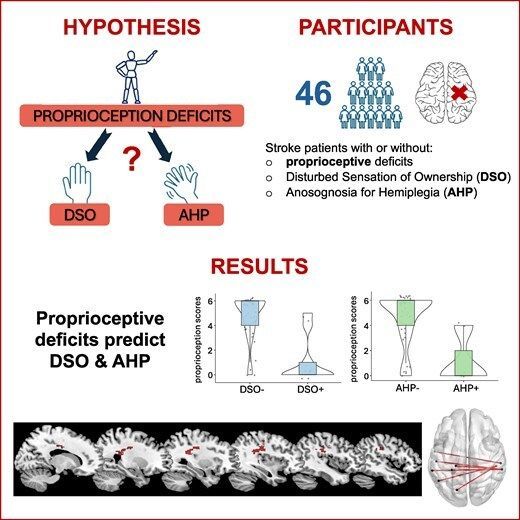 braincomms's tweet image. Salvato et al. report that proprioceptive deficits predict both disturbed sensation of ownership and anosognosia for hemiplegia following right-hemisphere stroke. Lesion mapping reveals damage to parietal regions and interhemispheric disconnections 👉 buff.ly/cEGwaft