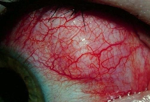 Vitani 🐇 tweet media