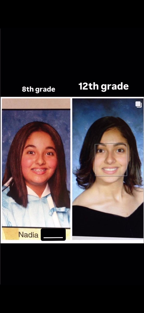 timepeacevisual's tweet image. 8th grade grad photo (left)
12th grade grad photo (right)
I came…..the longest way…and imma keep going #changes #fitness 🩻🗝️
