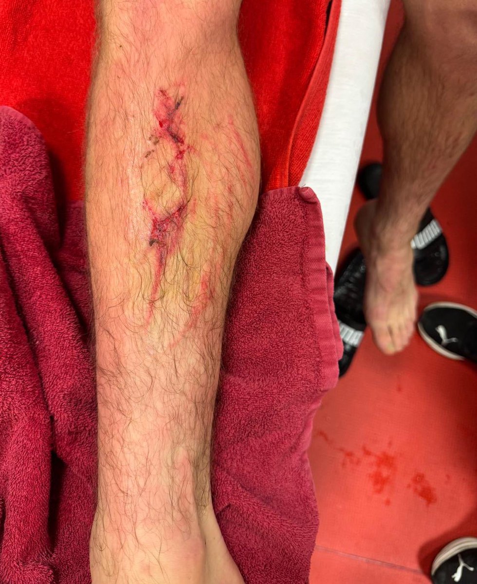 İbrahim Hacıosmanoğlu hadi çıkıp konuşsana, Galatasaray'ın hakkı yendi diye.