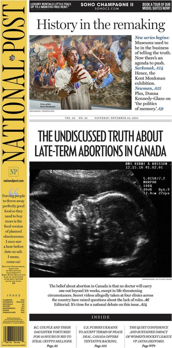LeslynLewis's tweet image. Canada is the only Western nation with no legal gestational limits on abortion (which means the law allows abortion at any point in pregnancy, even in the ninth month).

The @nationalpost has now confirmed what Canadians were told for years was not happening: late-term abortions…