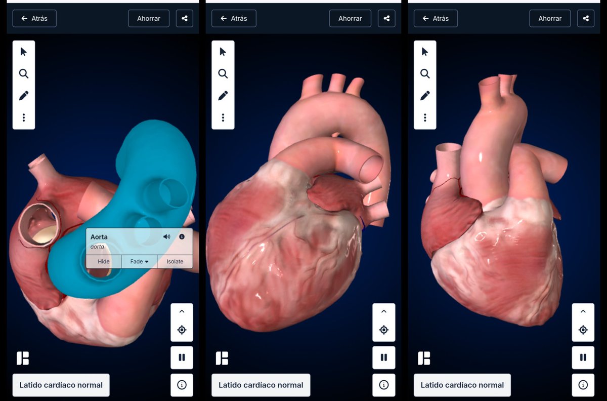 TicEducativas's tweet image. 🧠 ¡Lleven sus clases de Biología/Anatomía a otra dimensión! 🤩

BioDigital Human ofrece un cuerpo humano virtual 3D interactivo para visualizar anatomía, enfermedades y tratamientos. Es la #TIC perfecta para hacer el aprendizaje visual, simple y muy atractivo.

¡La…
