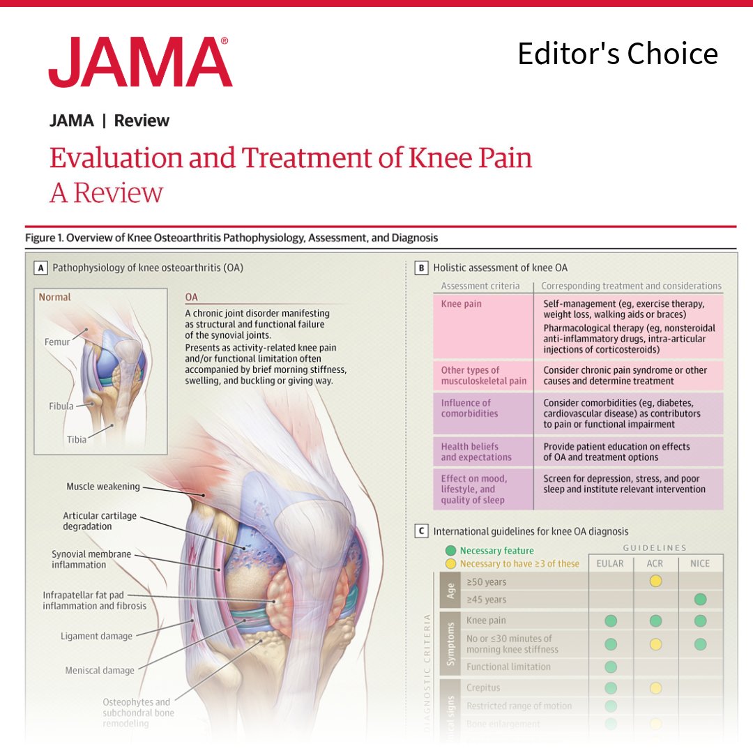 📢 ICYMI: This Review summarizes the diagnosis and management of adult #KneePain—with a focus on #osteoarthritis, patellofemoral pain, and meniscal tears. Globally, osteoarthritis impacts over 650 million adults. 

Add this to your reference manager: ja.ma/48bKo4K
