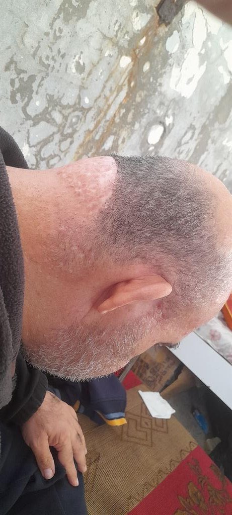 mohannad1789941's tweet image. I have an allergy to milk and fish. 
If you&apos;re watching this, please support my family. I need your help. 
If you&apos;re passing by, please leave a dot. It&apos;s just a dot.
gofundme.com/f/DONATE-HELP-…