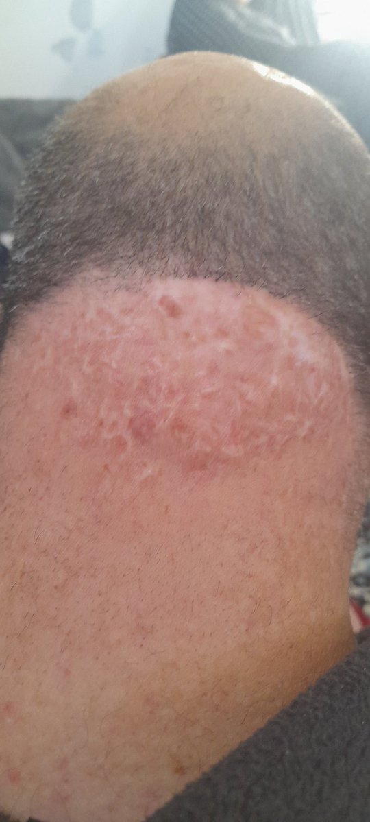 mohannad1789941's tweet image. I have an allergy to milk and fish. 
If you&apos;re watching this, please support my family. I need your help. 
If you&apos;re passing by, please leave a dot. It&apos;s just a dot.
gofundme.com/f/DONATE-HELP-…