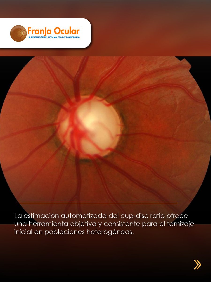 FranjaVisual's tweet image. ¿Puede la inteligencia artificial mejorar la detección temprana del glaucoma?

👉🏾 f.mtr.cool/czypfmybgr 👈🏾

#NotasFranja #Lentes #SaludVisualConEstilo #IA