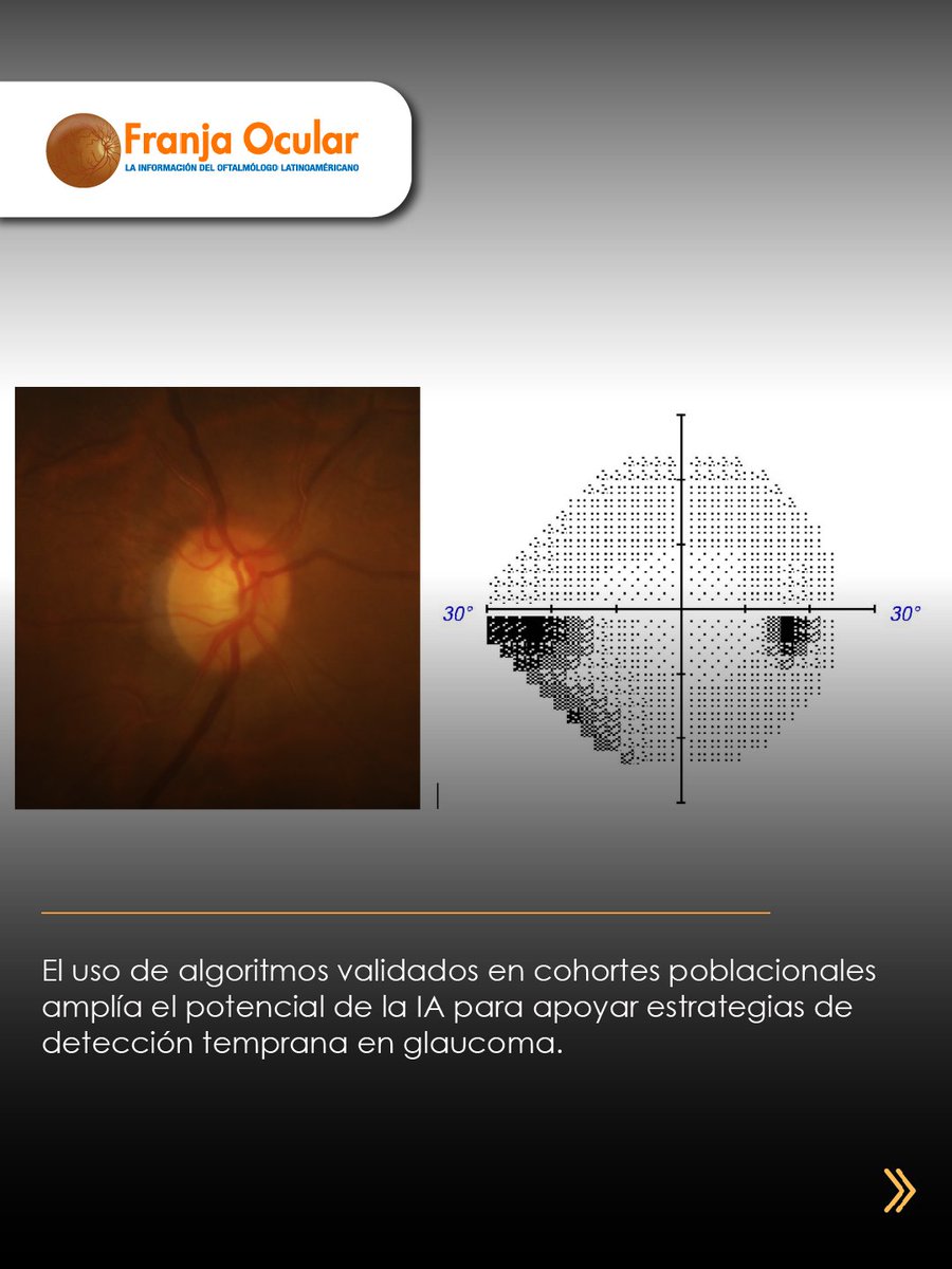 FranjaVisual's tweet image. ¿Puede la inteligencia artificial mejorar la detección temprana del glaucoma?

👉🏾 f.mtr.cool/czypfmybgr 👈🏾

#NotasFranja #Lentes #SaludVisualConEstilo #IA