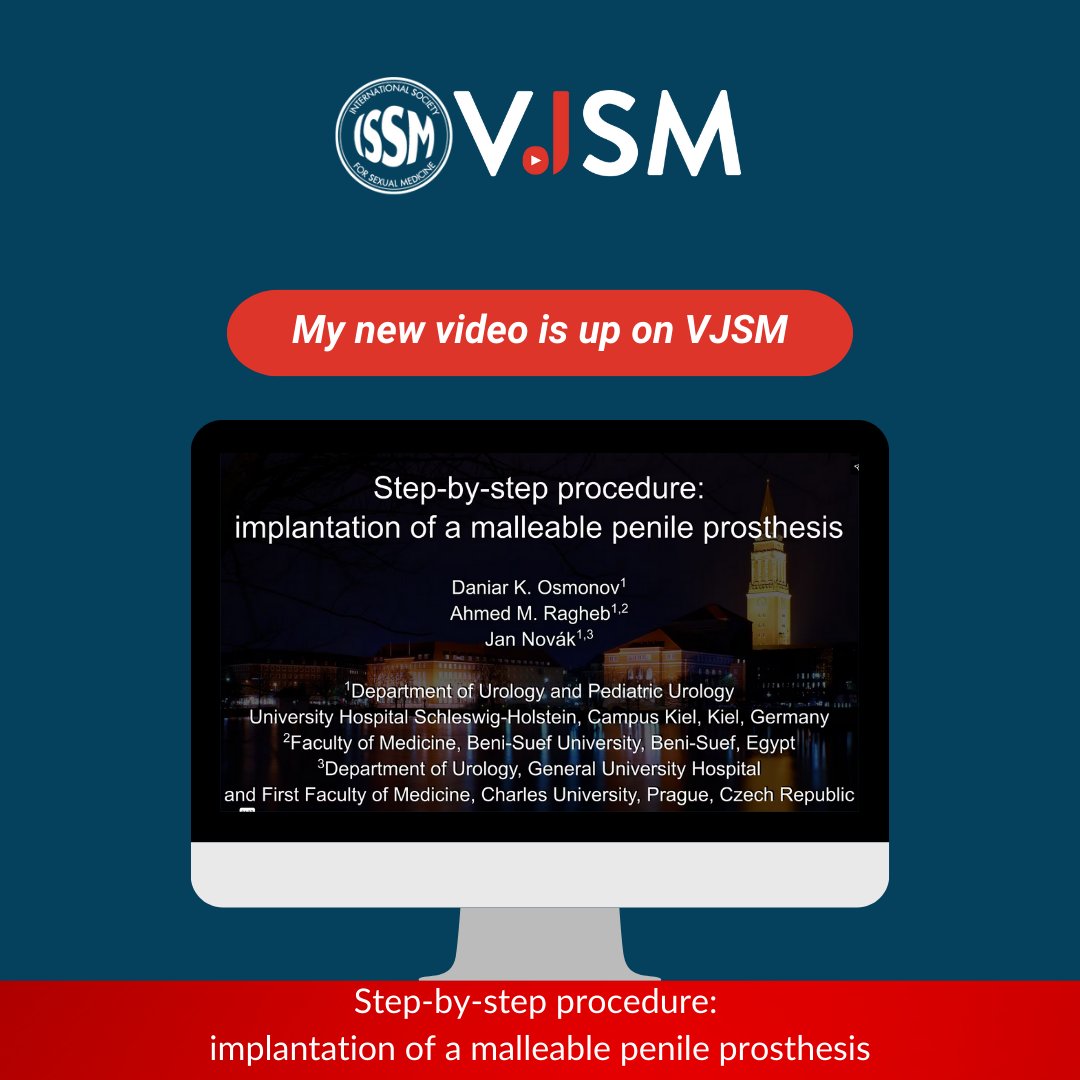 MUDrJanNovak's tweet photo. Excited to share that our video article "Step-by-step procedure: implantation of a malleable penile prosthesis" has just been published at #VJSM! Huge thanks to my amazing colleagues @OsmonovDr @ragheba @KoenraadvanRen1
@ISSM_INFO @essm_tweets #uroczech
https://t.co/YOIPtHZ9LN https://t.co/Wr7gQ92jps