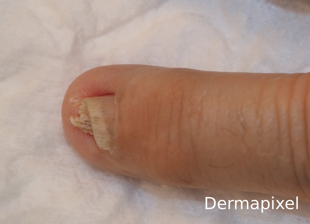 Rosa Taberner tweet media