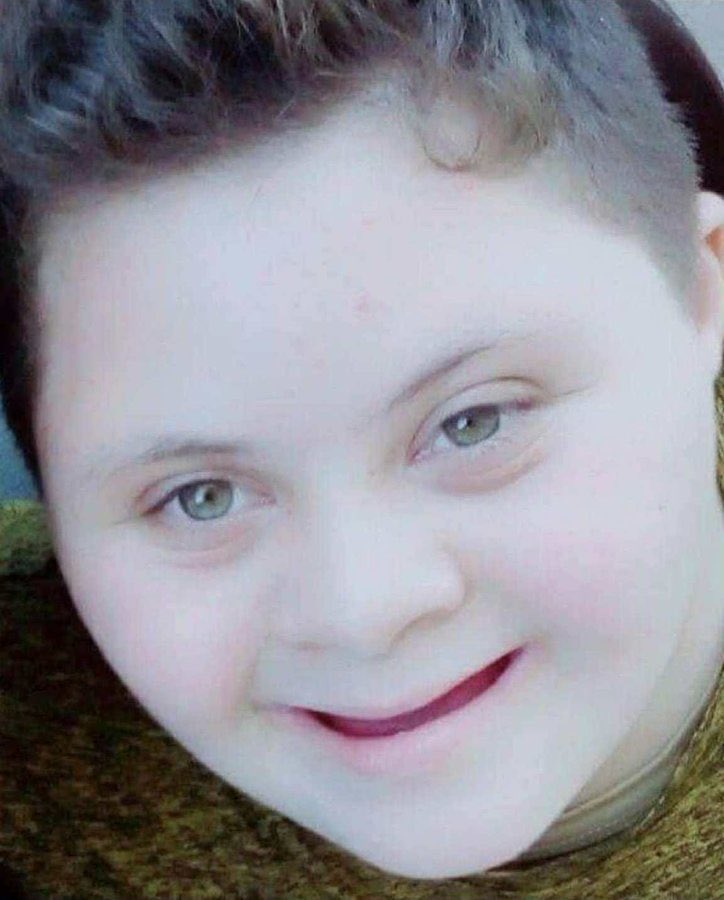 Hosam_hammad0's tweet image. Hello, this is my brother Ibrahim, he has Down syndrome. Please help him and stand by him.

If you’re scrolling, PLEASE leave a dot.

gofund.me/9b8303d3