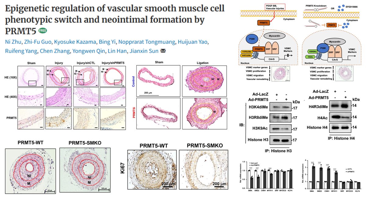 HaoYin20's tweet image. PRMT5 di-methylates H3R8 &amp;amp; H4R3▶️
⏬Myocardin-dependent #SmoothMuscleCell contractile gene transcription
⏫SMC proliferation/migration &amp;amp; intimal hyperplasia in injured🐭carotid artery

PRMT5 (&amp;amp; PRMT4) ⬆️in PDGF-BB-treated SMC &amp;amp; 👤coronary #Atherosclerosis

Evidence from
SMC PRMT5…