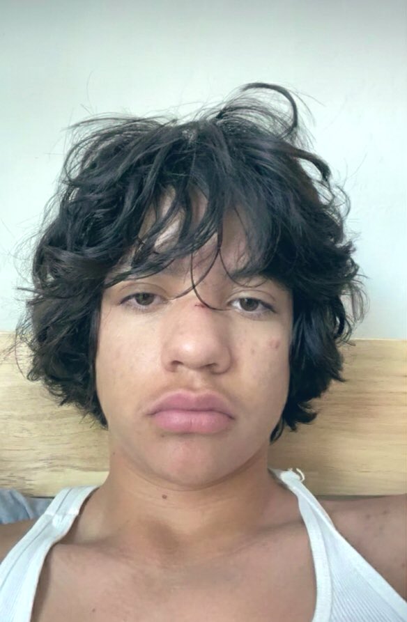 Bjelicaist's tweet image. Normalde kendimi paylaşmam da yorumlarınızı merak ettim, 1. Fotoğraf geçen senenin eylülünde çekildi, 2.’si de dün çekildi, 3/10 dan 7/10 olmuş bulunmaktayım ve halen daha incelim, bu halde olmamın sebebi ne olabilir?