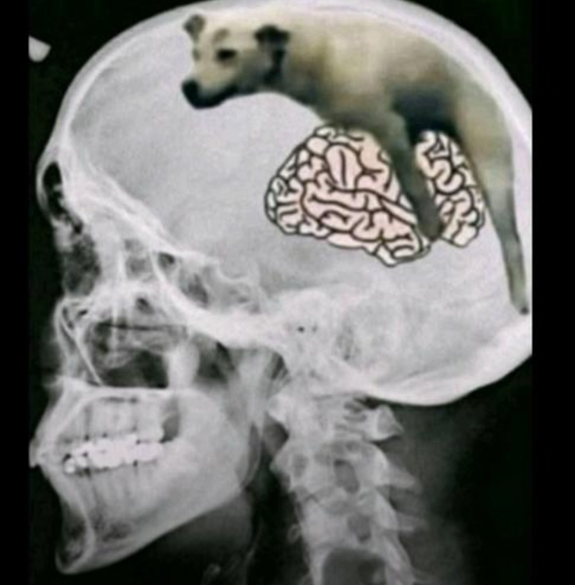 DilbertJorgan's tweet photo. @longshotmagoo @endracism001 What I imagine doctors see when they X-Ray you https://t.co/9vJotyG13r