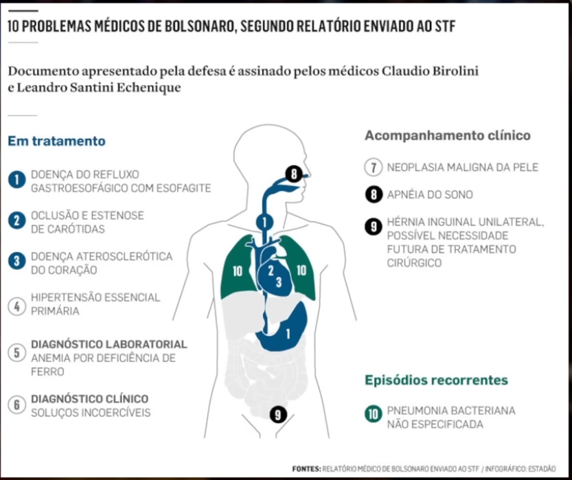 Esse é o homem perigoso, de 70 anos, que precisa de tornozeleira eletrônica, vigilância armada 24h/dia, vistoria diária em sua residência e foi recolhido à PF.

Canalhas!