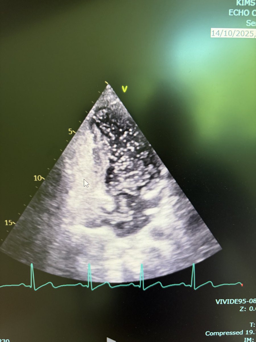 Manish Kumar Yadav tweet media