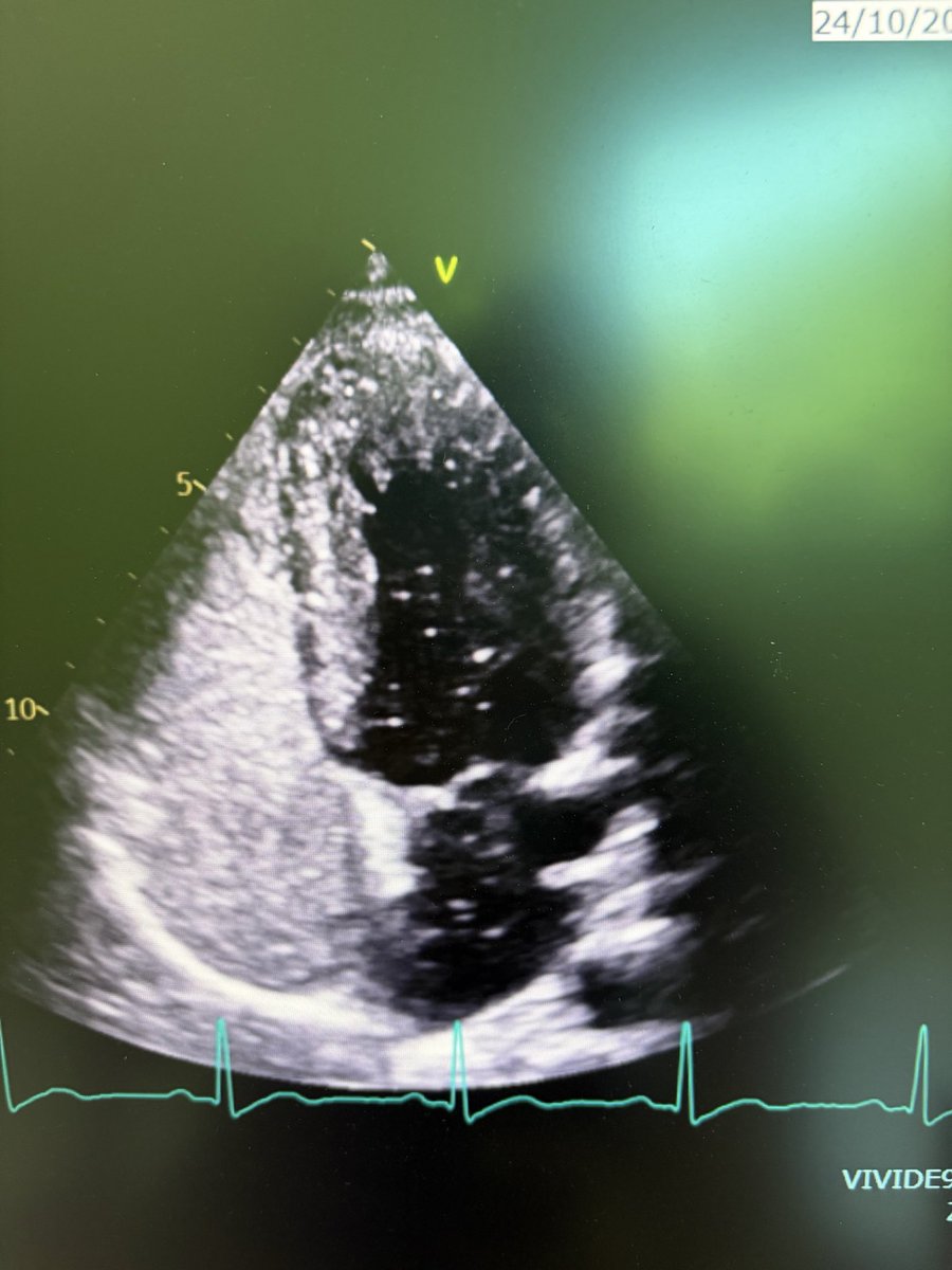 Manish Kumar Yadav tweet media