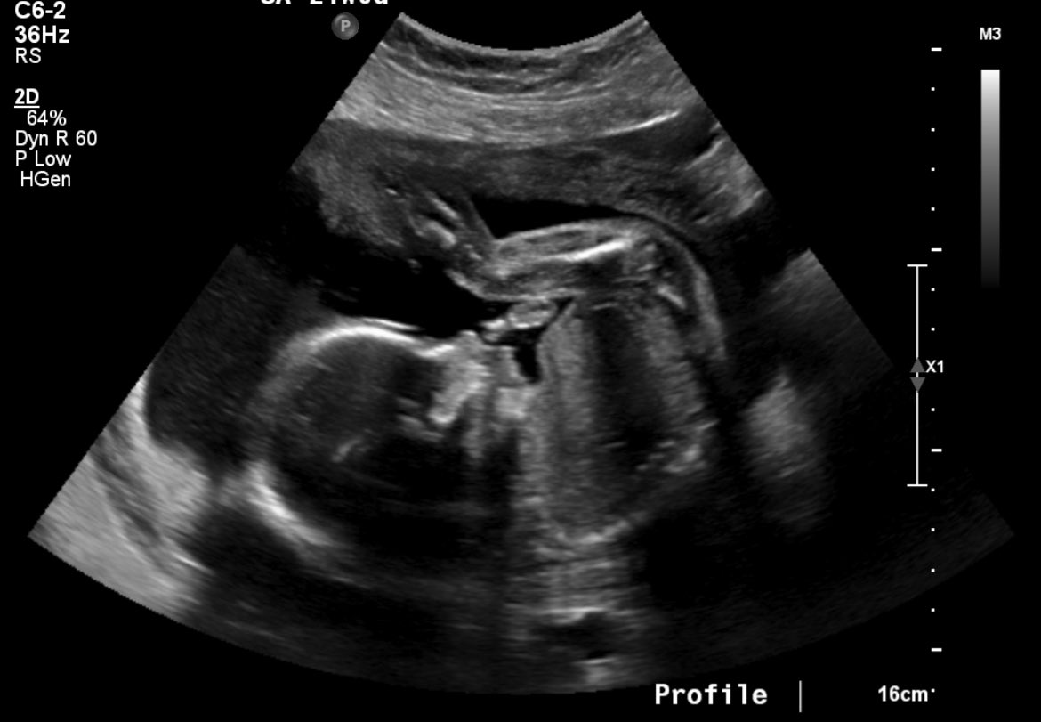 LSimms2's tweet image. In all the excitement the fall season brings for our family #IYKYK, we haven’t made it “social media official”. Baby Alvis #3 will be making HER debut in March. We are blessed and can’t wait to add another member to #TeamAlvis @CoachAlvis