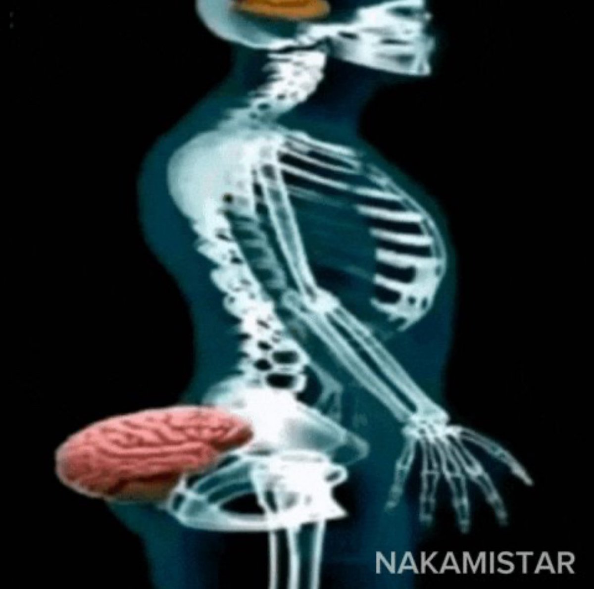 YassineTwts's tweet image. se marier avec un boug qui se faisait pepom dans la rue y a mm pas 2 mois