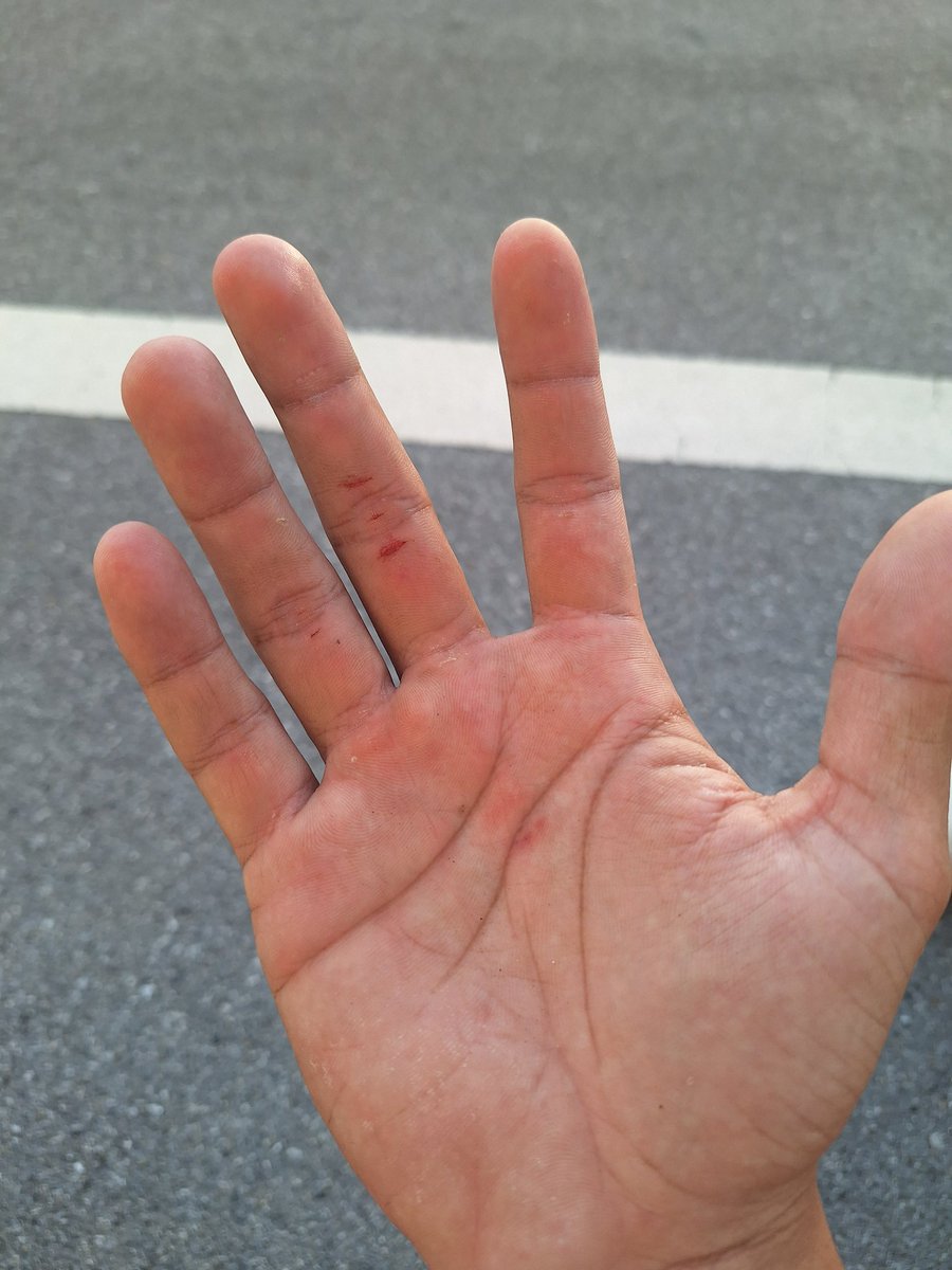 AffanSakolwaree's tweet image. Pov:เมื่อคุณเจอแป่นบาสที่คุณสามารถดั๊งได้ สภาพมือคุณ
#ZONATA #TamaGotchii #SigmaFangs #FumiHausu #Lucenes #Cerakins #AnyaAbyzz #Apostia #RexaChadx #LapiUU #L8Nighters