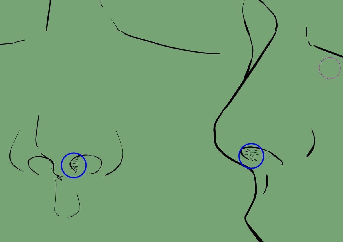 鼻毛抜くのは良くないってよく言われるけど、この辺の生えてきた瞬間に外界に顔を出す位置に生えてくるのもはや抜くしかなくない?って思いながらブラジリアンワックスで全抜きしてる 