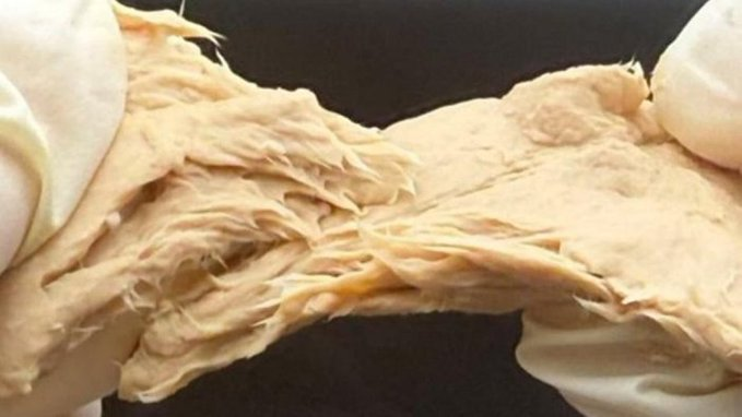 astronomiaum's tweet image. 🚨ATENÇÃO: Cientistas chineses criaram um fungo que pode ser consumido em vez de carne.
 
Pesquisadores afirmam que essa inovação culinária também pode ajudar a resolver a escassez global de proteínas.  

Eles usaram o Fusarium venenatum como base, o mesmo fungo filamentoso que…