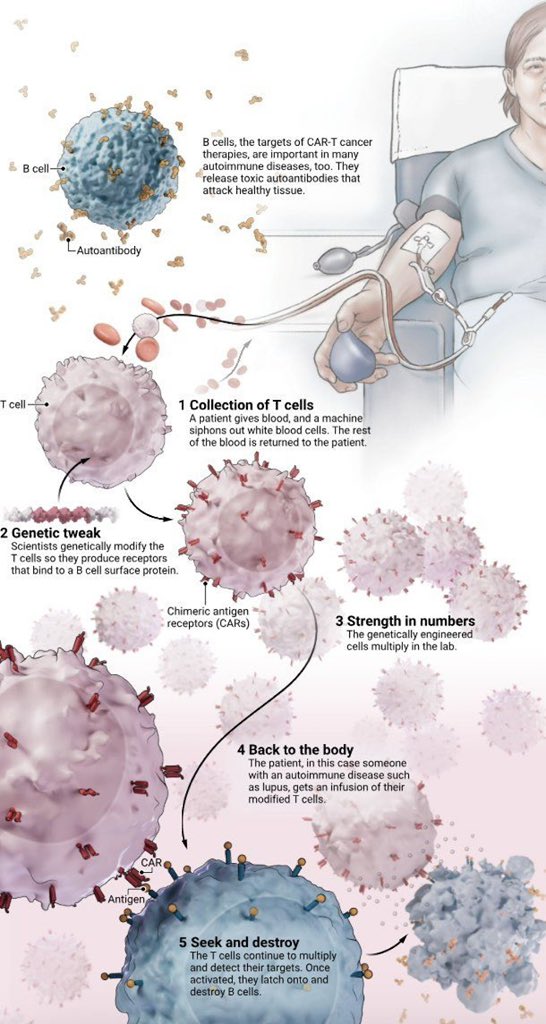 UPSCbasics's tweet image. CAR-T therapy, already approved for certain blood cancers, is generating excitement in early tests against autoimmune diseases. #UPSC