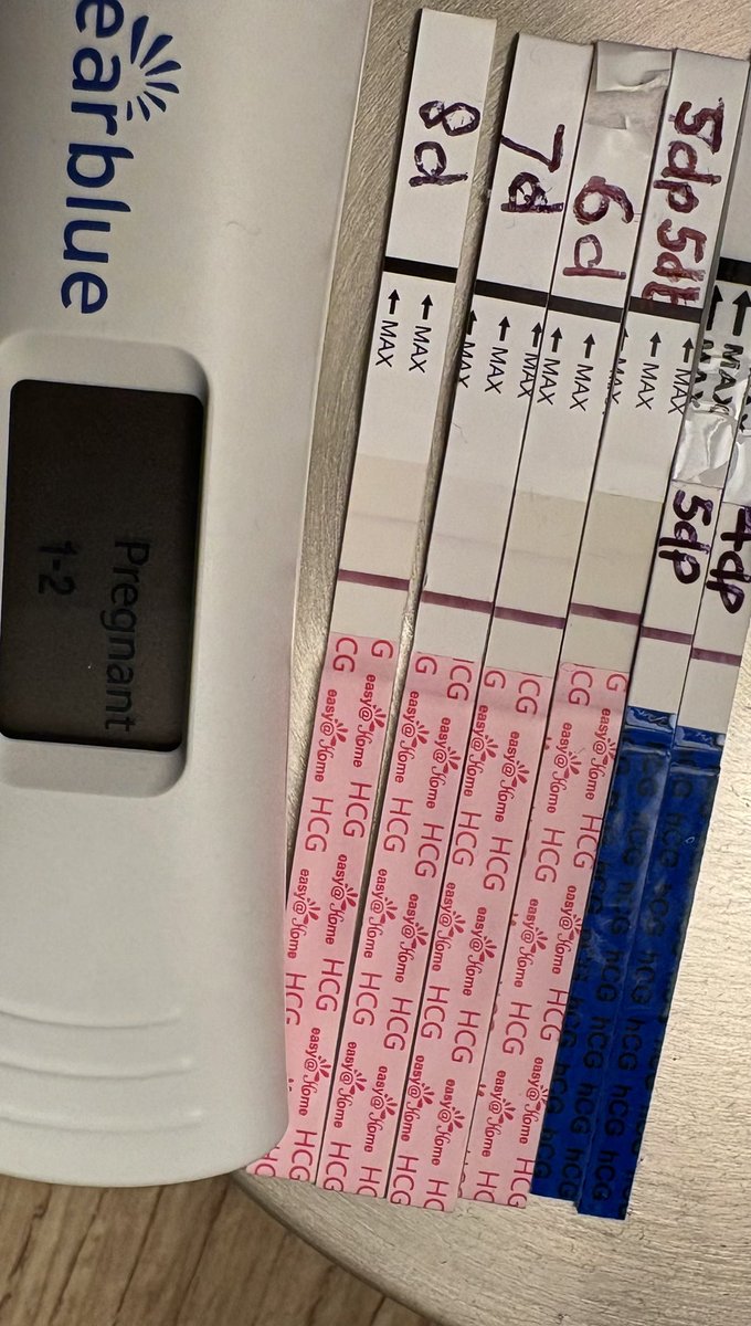 loopylou1000's tweet photo. Sensitive topic *****
Seems that our one little blast has implanted but whether or not it sticks is another thing as we all know so well. Becoming a POASA again 🥴. https://t.co/XskkBMa8Dy