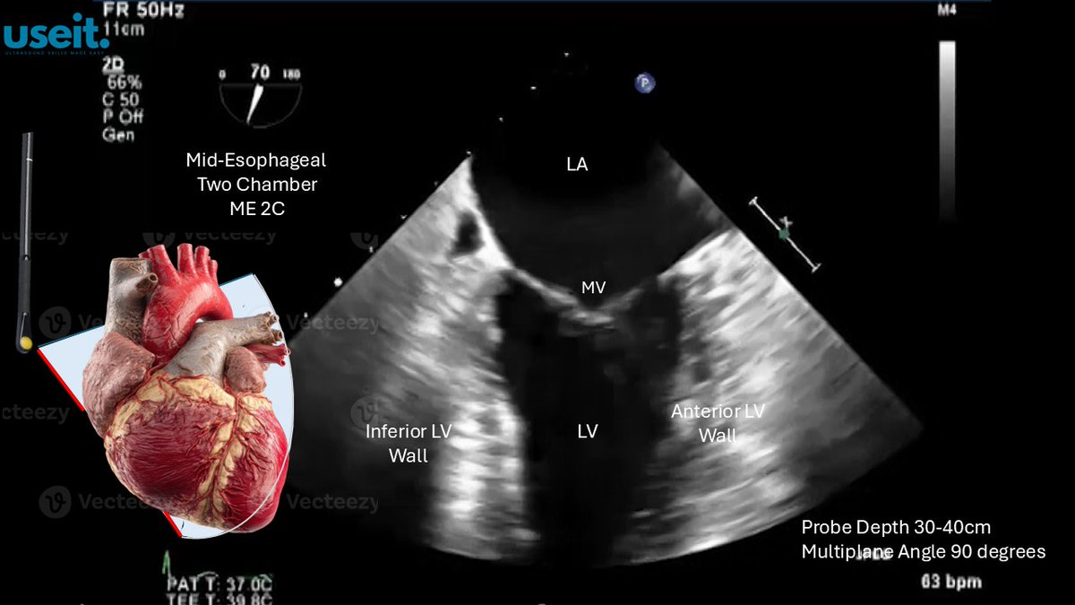 pocus_today's tweet image. #TEE #useit
ME2C View