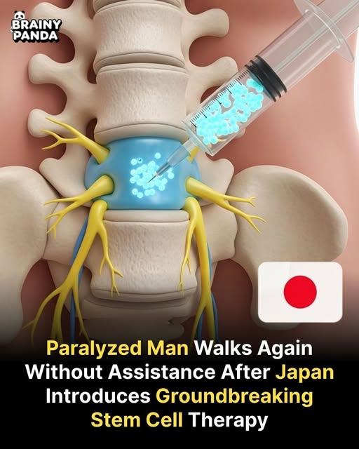 ImtiazMadmood's tweet image. A paralyzed man in Japan has regained the ability to walk unaided after receiving a pioneering stem cell therapy, a world first in regenerative medicine. This breakthrough treatment targets damaged spinal cord tissue, helping restore movement that was previously considered…