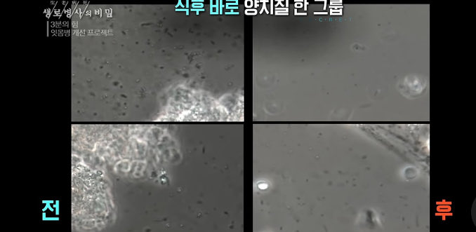 fullnadi's tweet image. 자기직전에 양치하면 양치 안한것과 같다는 것 아시나요😳

생로병사의 비밀에서 실험을 했는데 
식후 바로 양치를 하지 않으면 생성된 세균막이
자기전 양치를 해도 제거되지 않아 안한것과 같은 결과가 나왔다고 하네요

식 후 바로 양치를 생활화  합시다