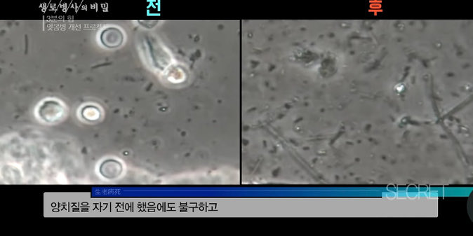 fullnadi's tweet image. 자기직전에 양치하면 양치 안한것과 같다는 것 아시나요😳

생로병사의 비밀에서 실험을 했는데 
식후 바로 양치를 하지 않으면 생성된 세균막이
자기전 양치를 해도 제거되지 않아 안한것과 같은 결과가 나왔다고 하네요

식 후 바로 양치를 생활화  합시다