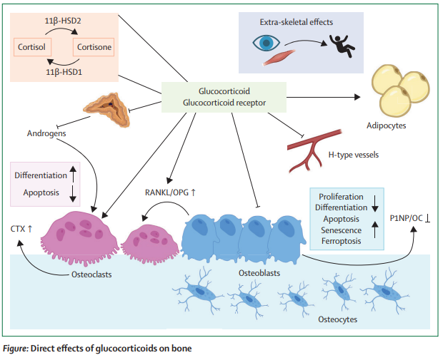 TheLancetEndo's tweet image. Severe #glucocorticoid-induced #osteoporosis requires a long-term sequential treatment approach consisting of a bone-anabolic agent followed by an antiresorptive drug thelancet.com/journals/landi…
#OpenAccess