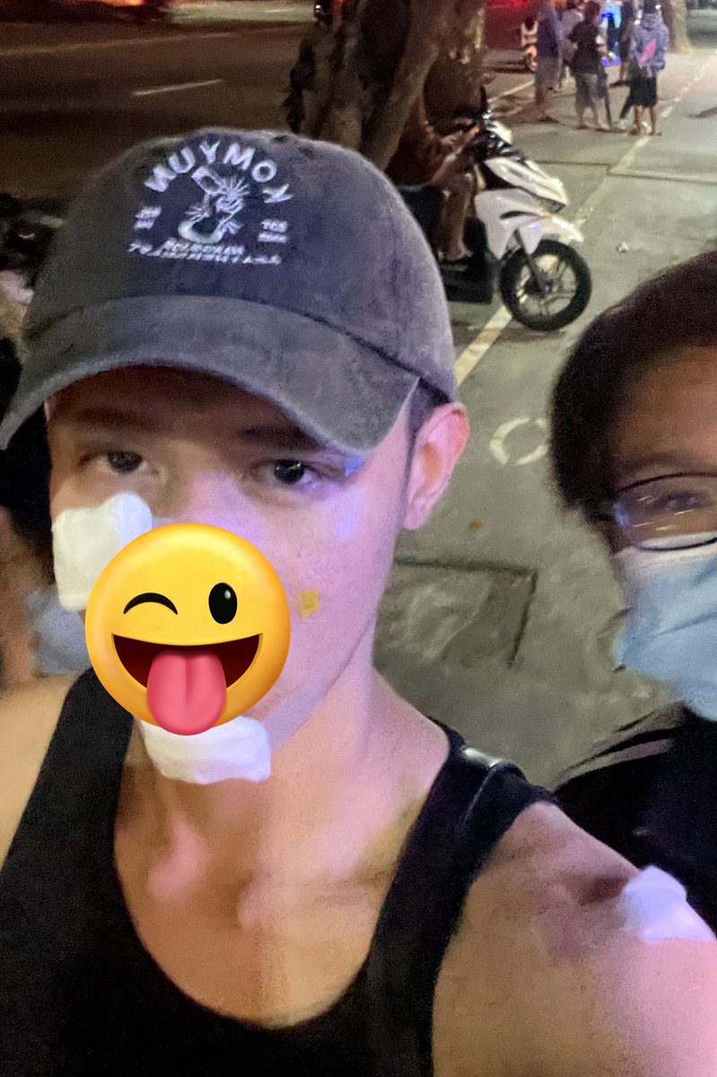 blobzter_'s tweet image. blobzter natagpuang nakipagbugbugan sa bar