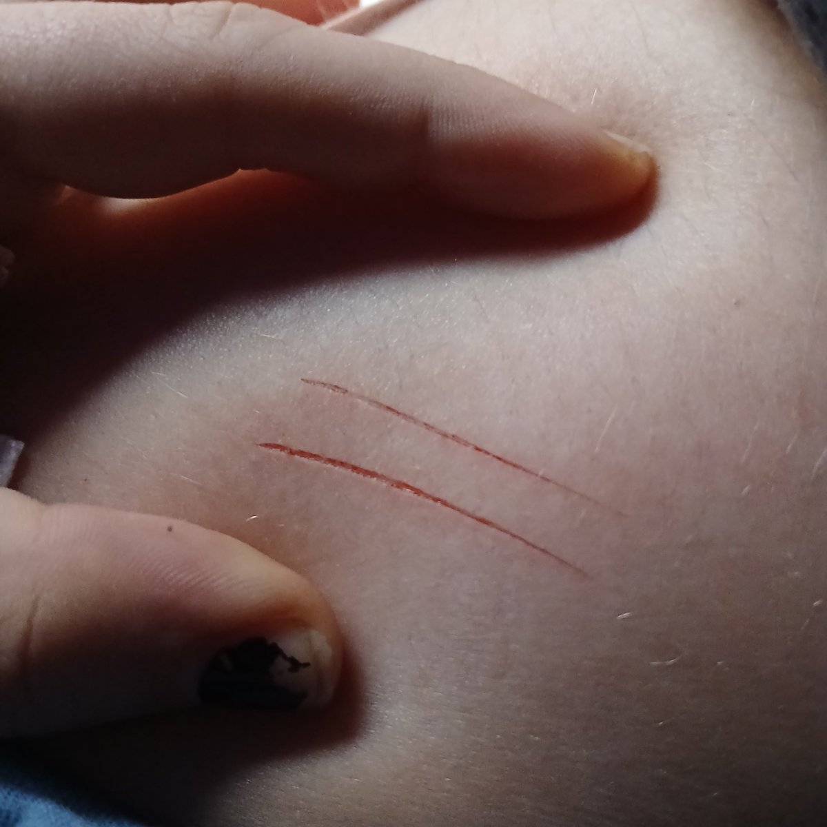 Azure0077's tweet photo. #selfharm #shtwt https://t.co/KkSjEYnXW9