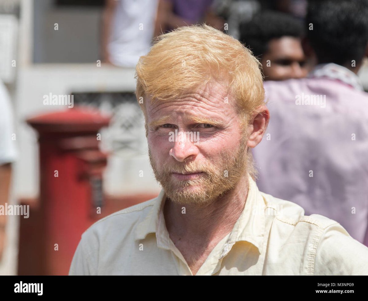 UBERSOY1's tweet image. This is an Albino Indian btw