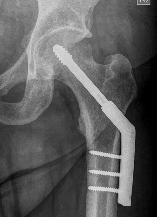 Webokv1's tweet image. Hoy se cumplen 2 años desde que ando enfierrado