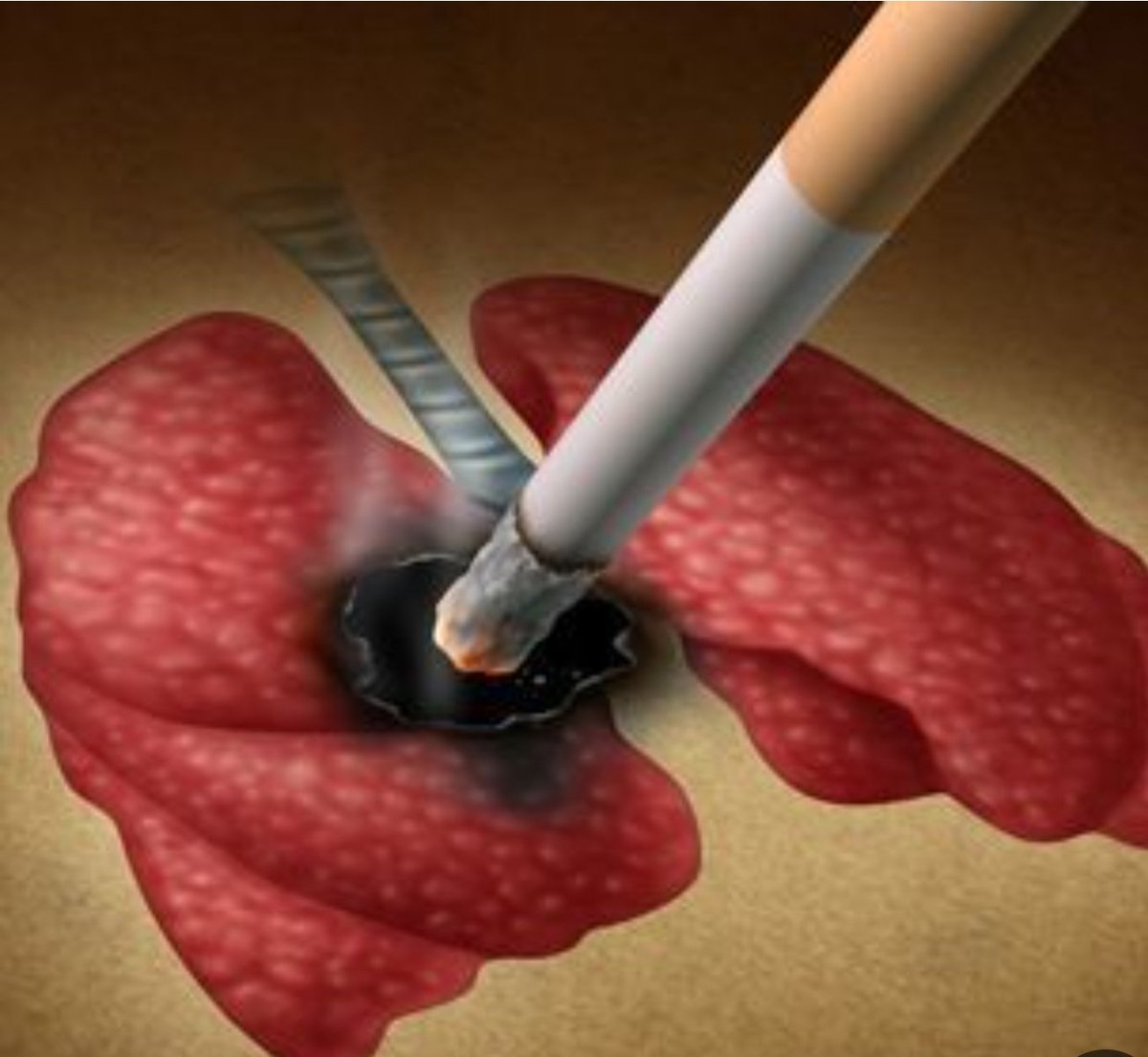 اليوم بعد صلاة الفجر نزلت أدور صيدلية…
لكن اللي شفته كان صفعة حقيقية:
محلات المعسّل فاتحة أكثر من الصيدليات.
شارع كامل قافل… إلا “الدخان”.
ضريبة 100%؟
ولا كأنها لمست أحد.
🤚وقتها فهمت الحقيقة العارية:
الناس ما تدخّن… الناس مُستَعبَدة.
التبغ مو هواية ولا مزاج…
التبغ مادة تكسر