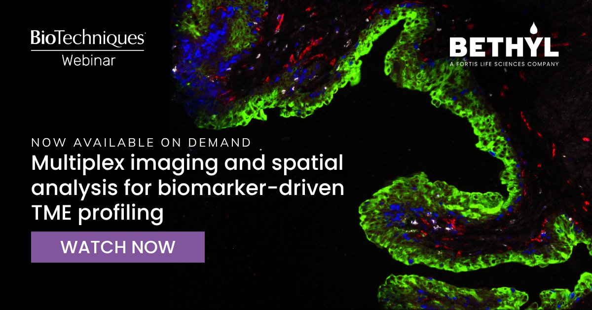MyBioTechniques's tweet image. Are you working with multiplex immunofluorescence and spatial biology?  

Check out our latest webinar which features insights on precision and reproducibility in spatial biology workflows for translational research. 

Watch on-demand &amp;gt;&amp;gt;&amp;gt; hubs.ly/Q03PtM_w0