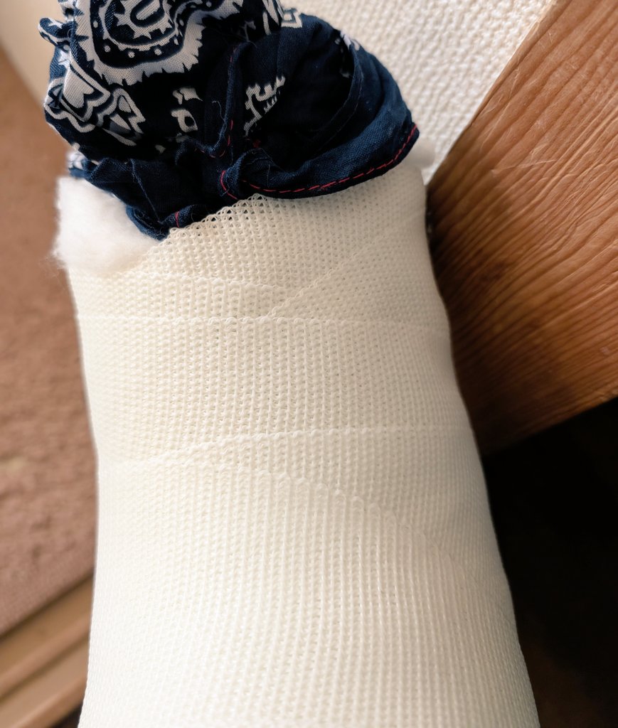 S_FukaseSEKAOWA's tweet photo. しかし今時のギブス？ってすごいねぇ〜
石膏じゃないのね（古っ）
カッチカチのテープみたいなやつ？
あ、これ足です😅

そろそろ歌ってもいいんだよ！
歌いたいんでしょ〜www
🎶ブロークンボーン⋯ボ、ボボ⋯🦴
#骨折　#ギブス　#Brokenbone https://t.co/tElu0eWznz