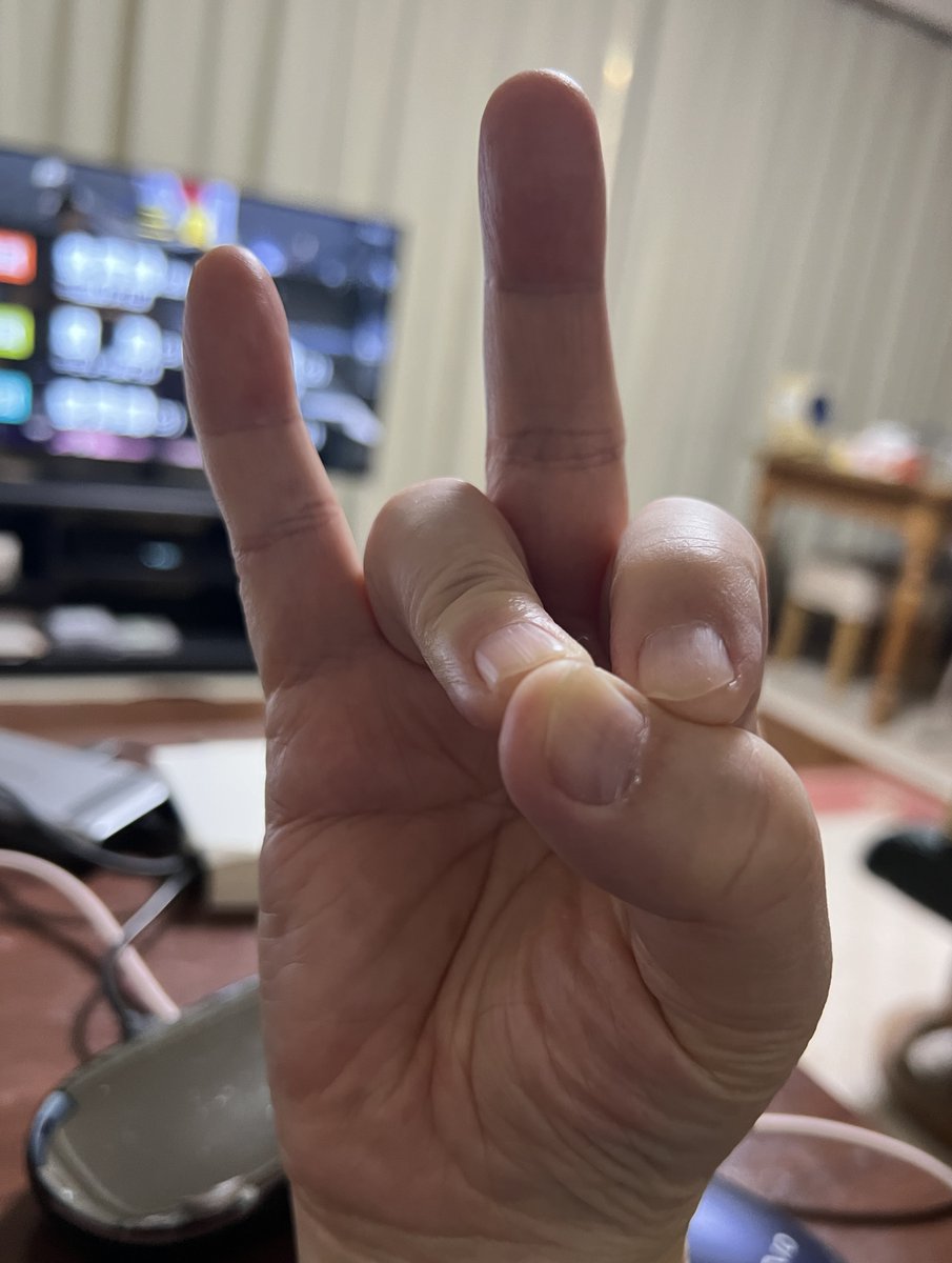 toruiwa's tweet image. こういうこと？
あっという間にできたけど。

たぶん私が何か間違えて
いるんだろうね。

10人に1人しか出来ないらしい #funnyshorts #funnyvideo #funnyvideos youtube.com/shorts/zIdqBWd… via @YouTube