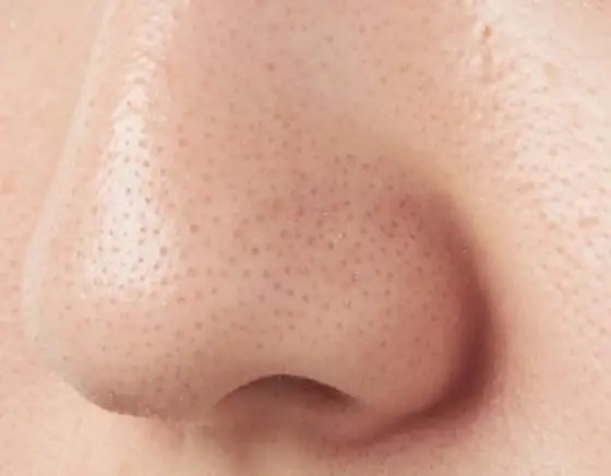 ちな、小鼻のプツプツとか毛穴開きこれでマジで消えた。中学から悩んでたからいまだに受け入れられないw本当にビビってる。