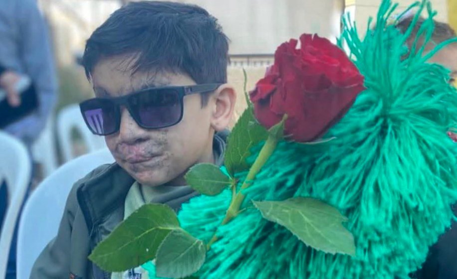 JulianSayarer's tweet image. Hussein Haini is a 12 year old Lebanese boy who suffered life-altering injuries when an Israeli terrorist attack saw his parent&apos;s device explode in his face after he picked it up. 

@lloyd_rm should ask Hussein what is &quot;more acceptable&quot; before giving his next colonial &quot;opinions&quot;.