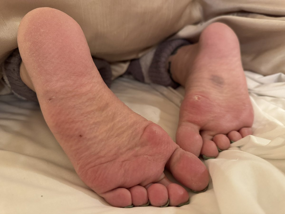 右足にアザがあるのは○○を全力でクラッシュしたからw(リクエスト動画)

#足裏
#足裏フェチ
#生足
#foot