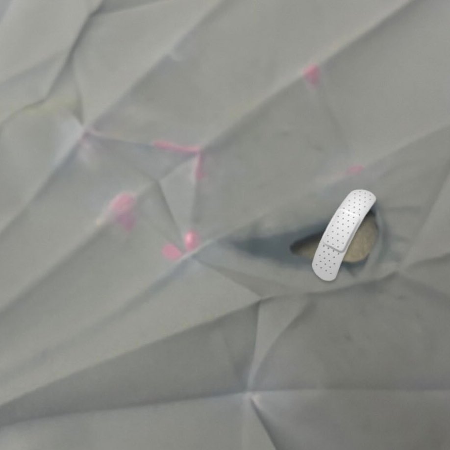 ケガしちゃった(;o;)